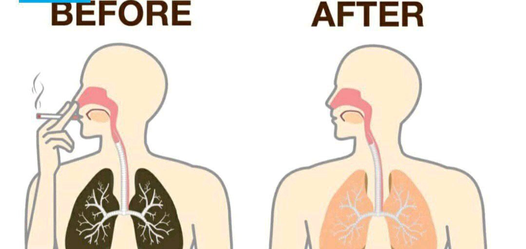 All smokers, do the following things to detox all the nicotine in your body