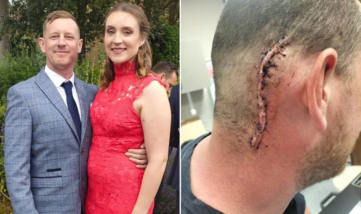 I’m selling my house to fight incurable brain cancer — the drug will cost at least £16,000