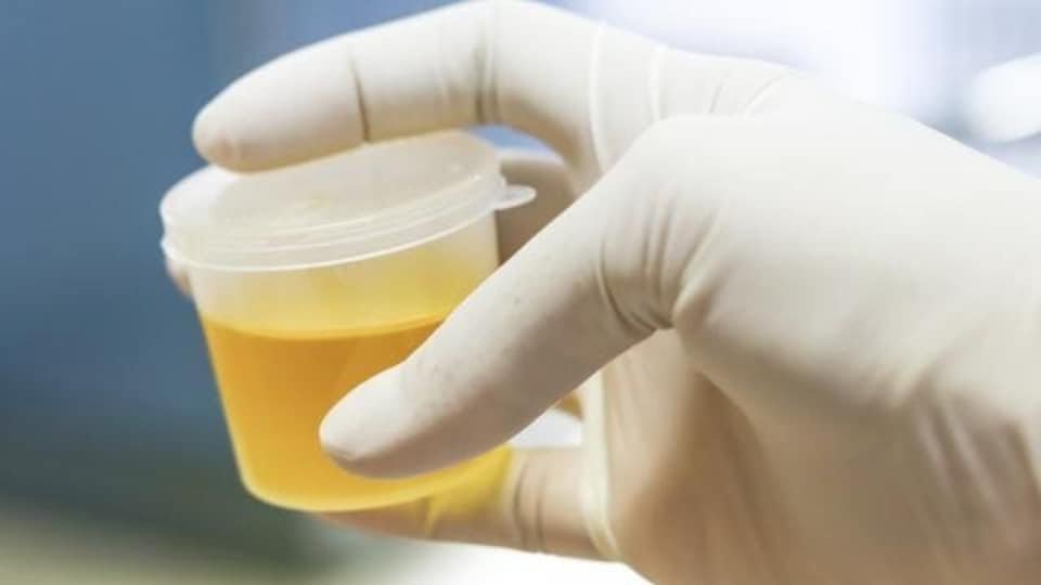 Once Your Urine Start Foamy Like This, Just Know That This Might Be Happening To You