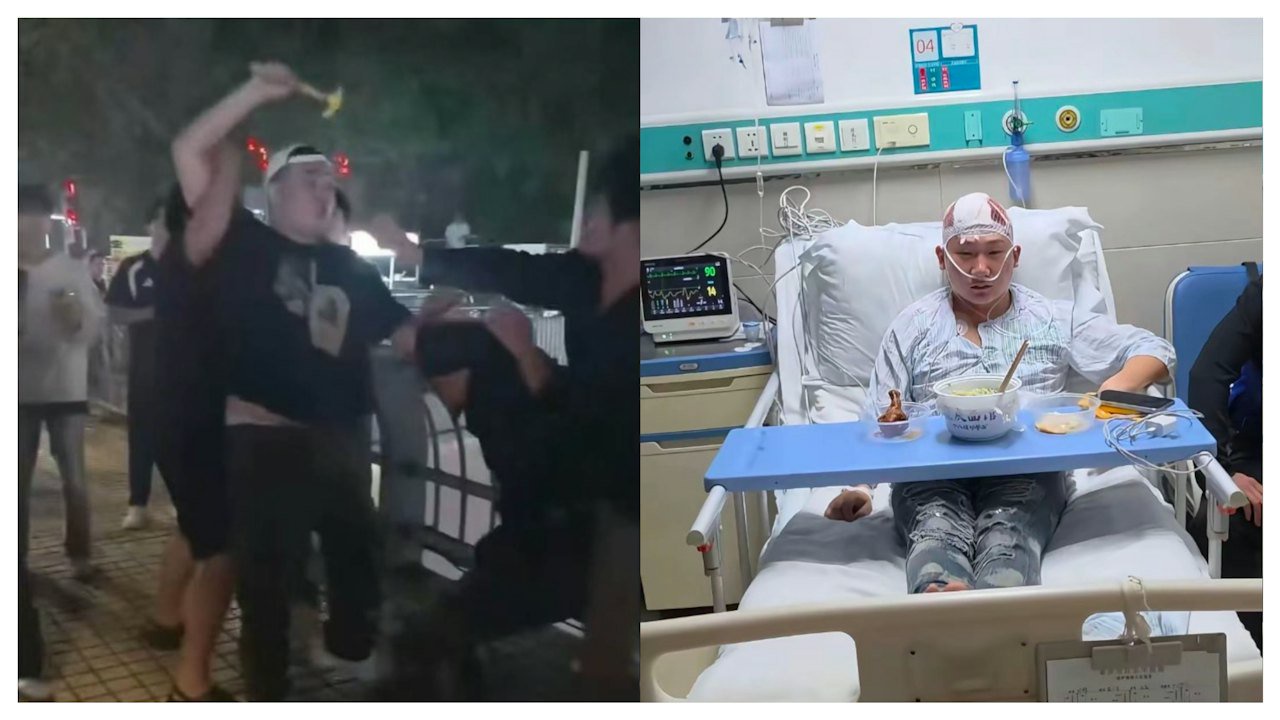 Chinese Influencer Wang Bian Attacked with Hammer and Knife in Chongqing by Ex-Manager Over Financial Dispute
