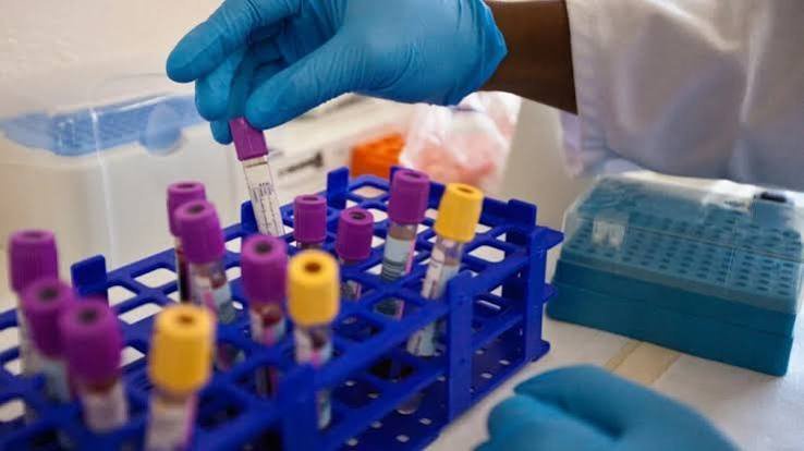 Zim Researchers Urged to Tackle Emerging HIV Complications