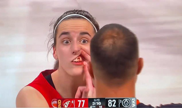 Caitlin Clark left bloodied as Indiana Fever crash out of WNBA playoffs after tense clash with Las Vegas Aces