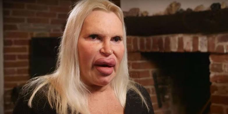 Botched plastic surgery, check out the images