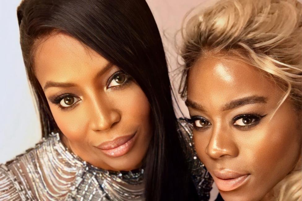 I lost my hair to MS treatment – now my wigs are worn by Naomi Campbell and Serena Williams