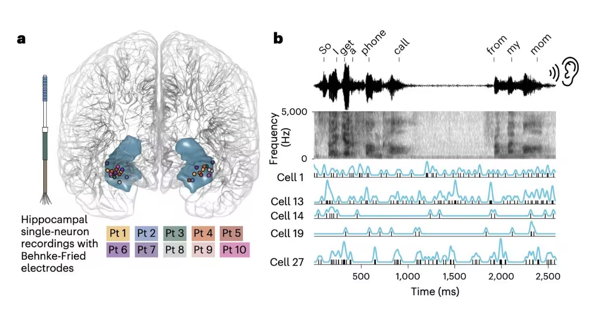 Neuroscience AI research reveals how the human brain processes spoken words