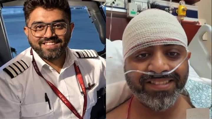 Captain Smit Machchhar suffers depressed skull fracture: Here’s what it means