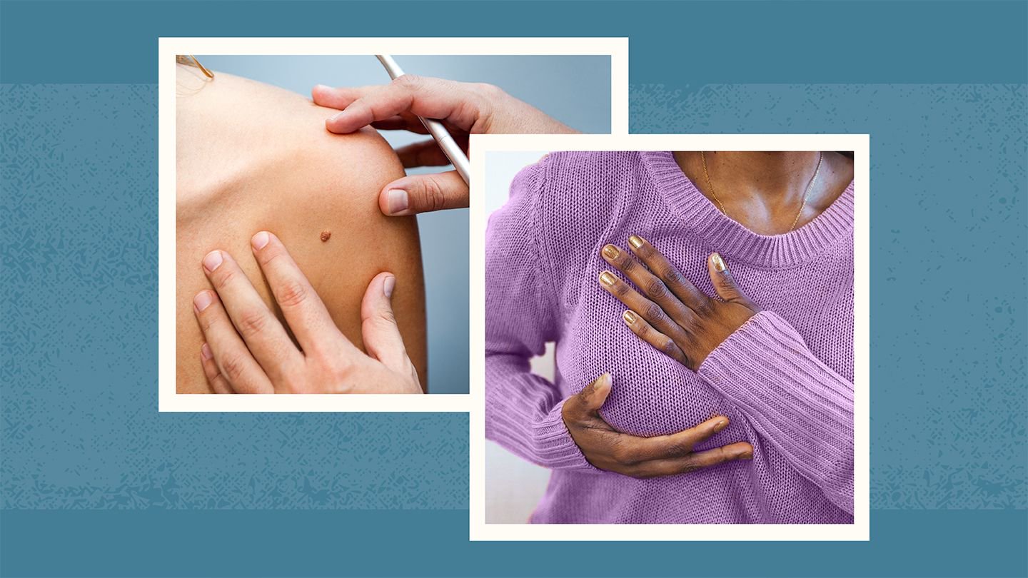 Early Symptoms Women Often Miss That Could Signal a Serious Disease