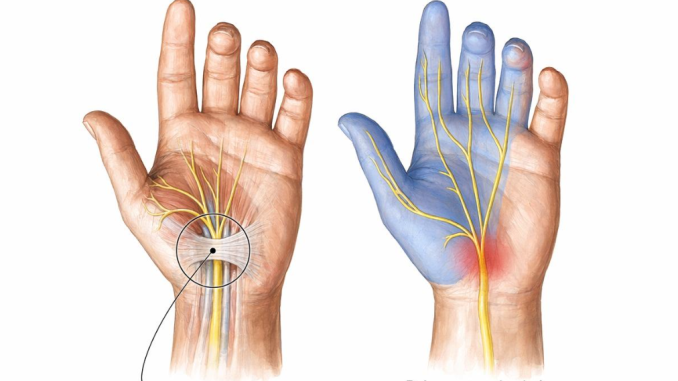 6 Reasons Your Hands May Feel Numb or Tingly