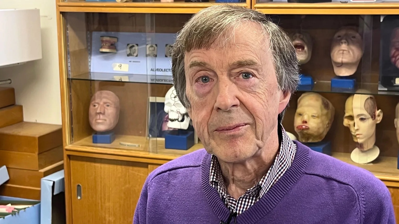 ‘I could never hear on my left side – until I got a prosthetic ear’