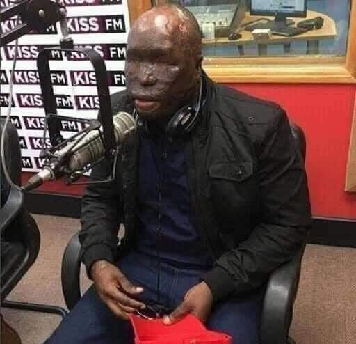 He Was Not Born Like This, His Wife Did It To Him
