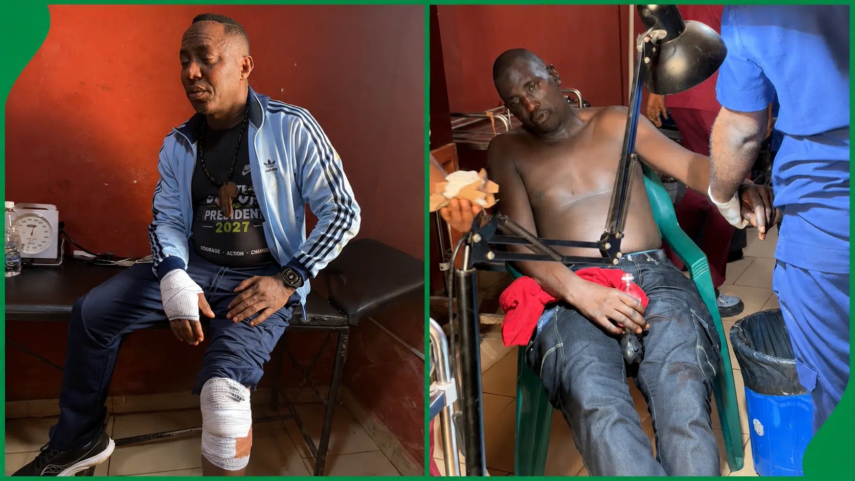 Sowore Breaks Silence, Releases Pictures, Videos After Attack In Ekiti