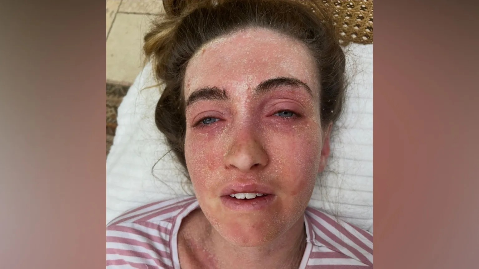 ‘Posting on TikTok helped me through a dark time’