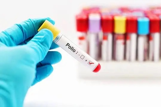 Ghana Finally Closes Type 2 Polio Outbreak as World Polio Day 2026 Is Marked