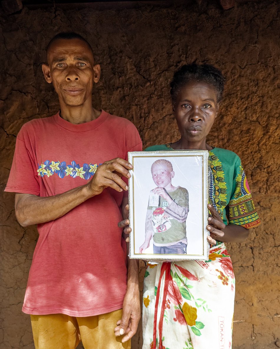 Murdered for their eyes: people with albinism living in terror in Madagascar