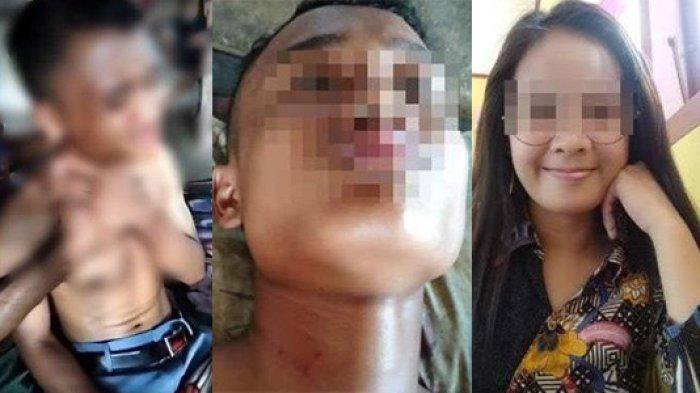 SOSOK Matanya Halawa Siswa SMA Nias Diduga Dianiaya Guru Honorer Sampai Pingsan dan Tak Bisa Bicara