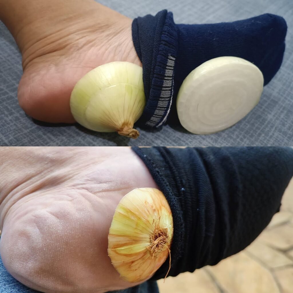 The Surprising Advantages Of Sleeping With An Onion In Your Sock