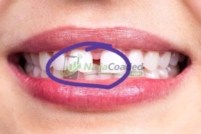 Stop Referring To It As ‘Gap Teeth’ Or ‘Open Teeth’, This Is The Correct Word To Say