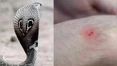 Woman from Maharashtra dies of snakebite despite treatment at three hospitals