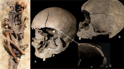 Domestic violence and possible ritual sacrifice in Iron Age and Viking Age Scandinavia: 12 individuals reveal brutality and inequality