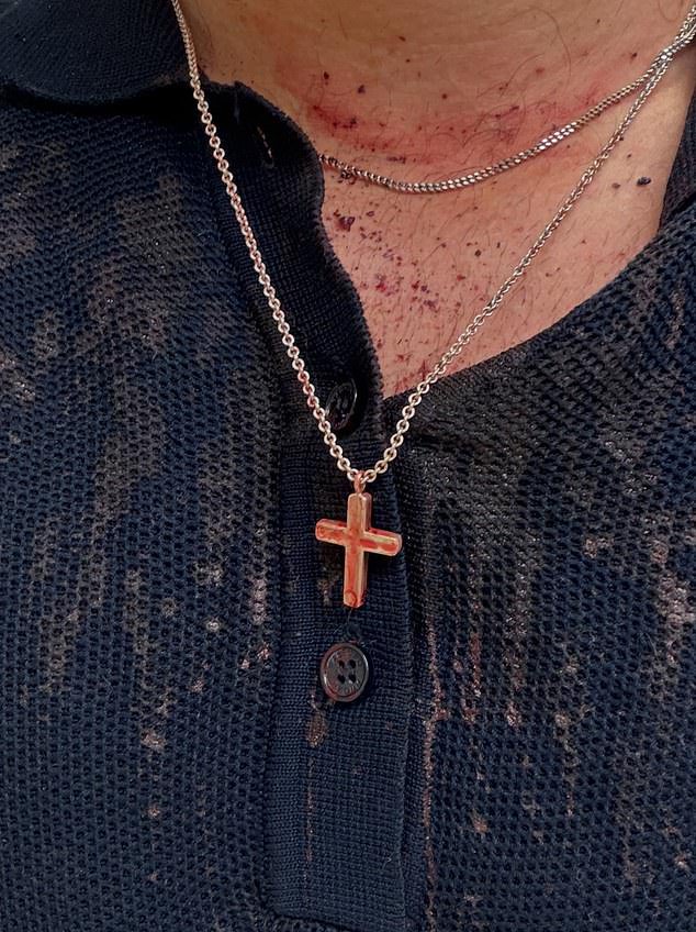Pretty Little Liars star Keegan Allen shares harrowing photo of his blood-soaked cross necklace after attack in LA