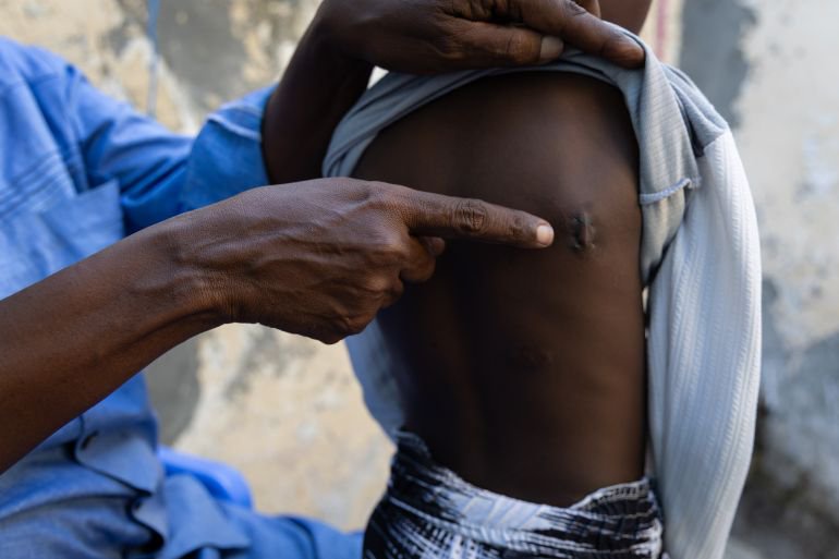 The human cost of surging US air strikes in Somalia