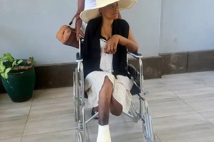 Model lost her arm and leg fighting her powerful ex-husband in a 7-year legal battle and now, she’s free