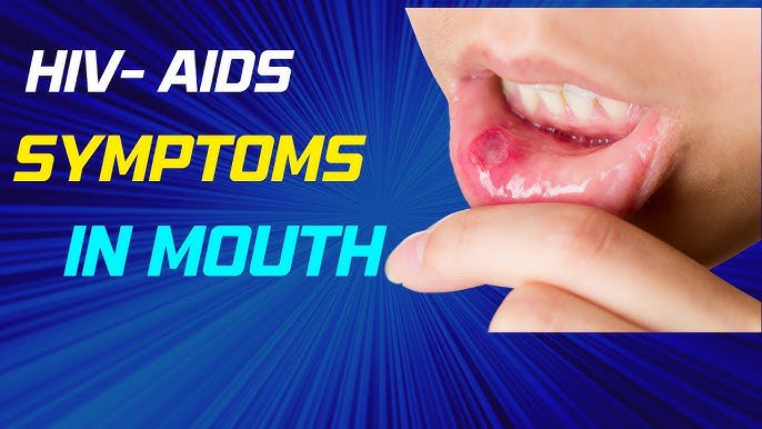 Common Mouth and Skin Signs of HIV You Shouldn’t Ignore
