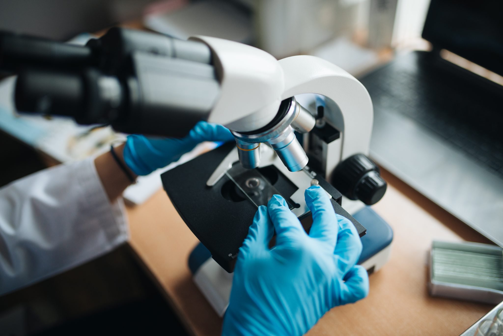 Human lung organoids retain immune cells in new research model
