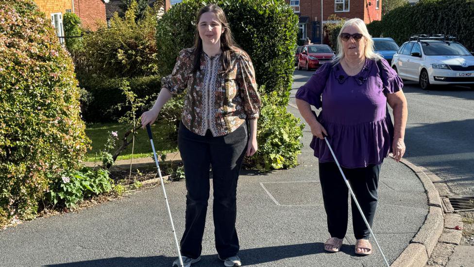 Allergies leave blind woman without guide dog