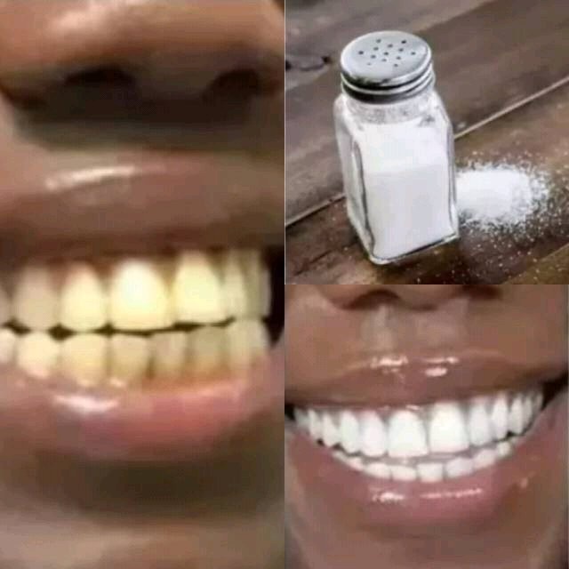 How To Remove Deep Brown Stains From Your Teeth With These Kitchen Ingredients