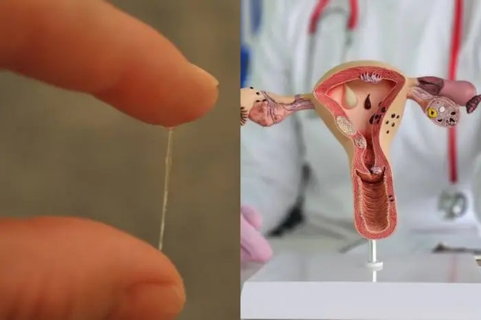 6 foods that may help support healthy cervical mucus