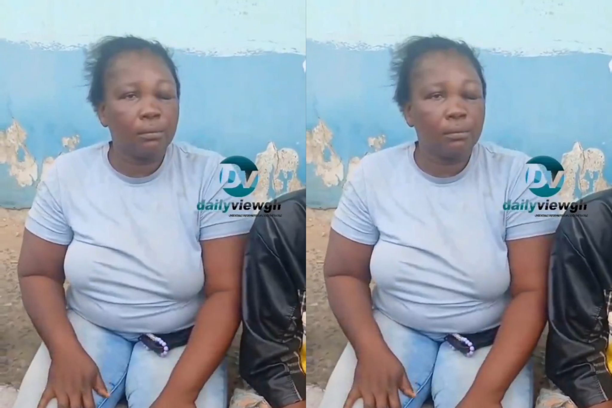 Kasoa Youths Beat Mother Of Five, Leave One Of Her Eyes Swollen After She Was Caught Doing “This” To A School Boy At Night During Prayer Session
