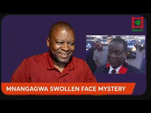 WATCH LIVE: Mnangagwa Returns To Zimbabwe With Swollen Face