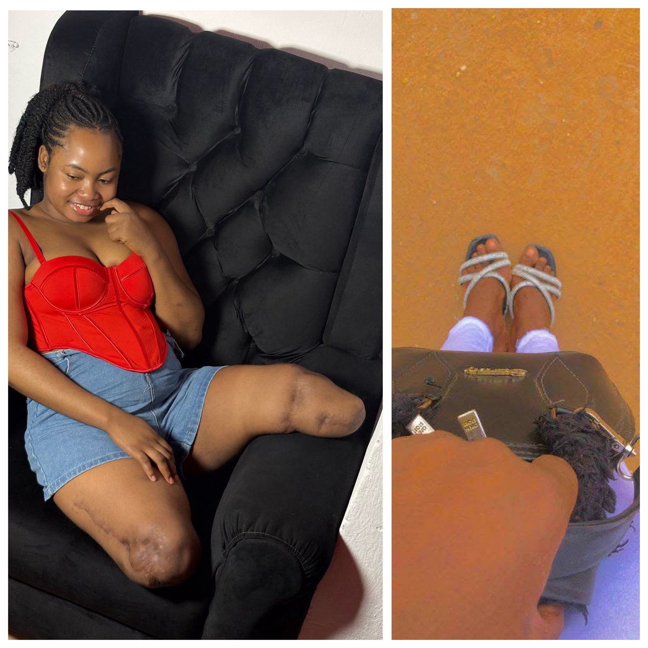 I wish I stayed home that day – Nigerian woman who lost both legs in accident shares her regrets