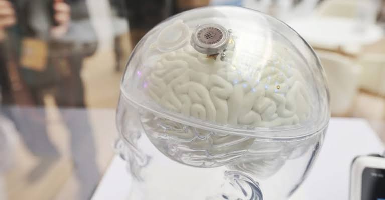 China approves brain implant to help paralysis patients use hand