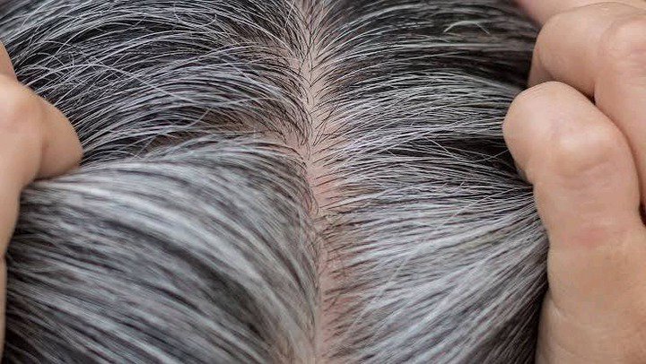 Say Goodbye To White And Grey Hair Using These Remedies