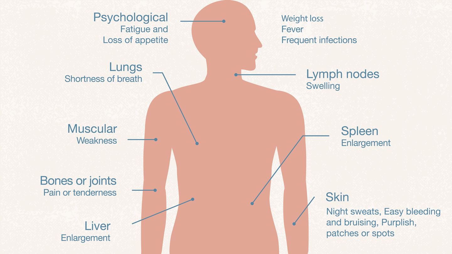 Early Signs of Leukemia You Shouldn’t Ignore, According to Health Experts