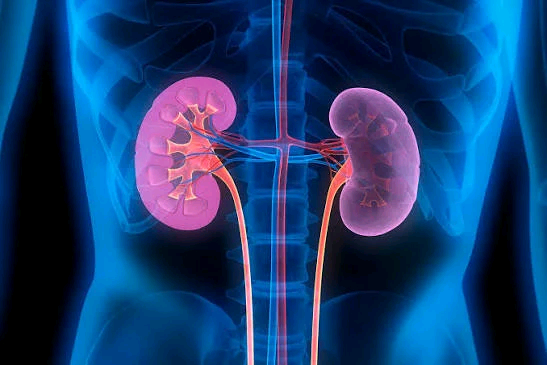 Kidney Failure: A Silent Threat Nigerians Can No Longer Ignore