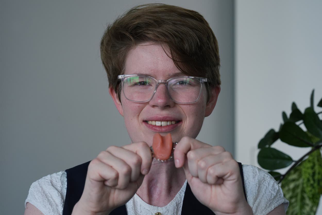 Cancer survivor who was left with speech problems given artificial tongue in NHS first