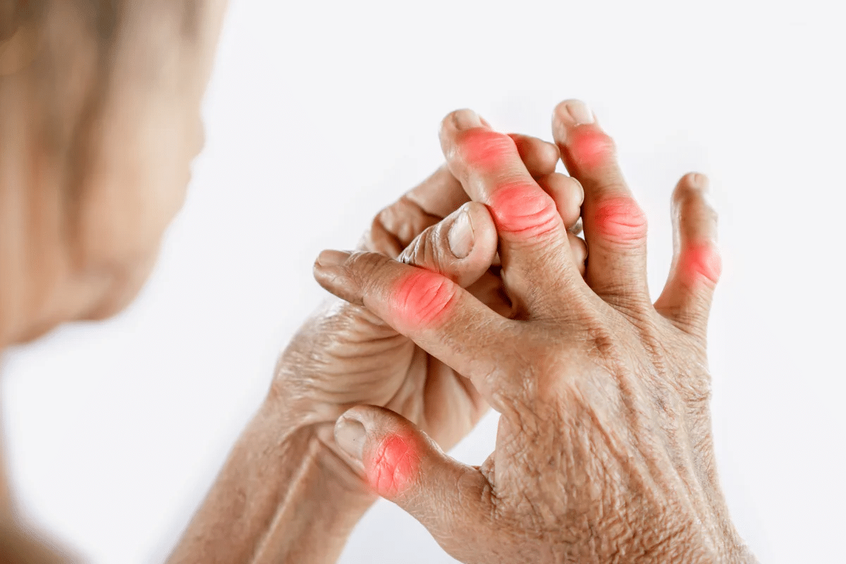 3 Habits to Avoid to Reduce Your Risk of Arthritis