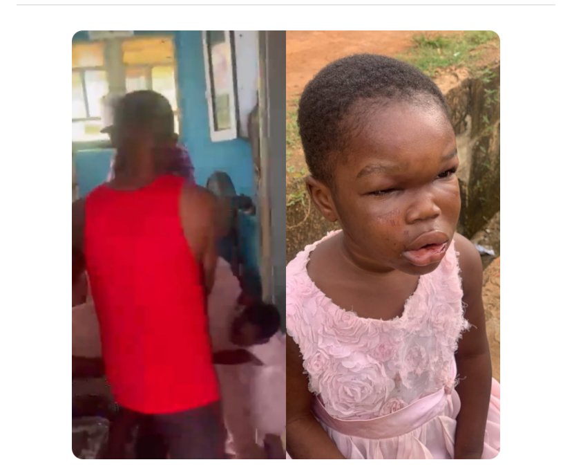 Man accused assaulting 3-year-old stepdaughter while her mother does nothing