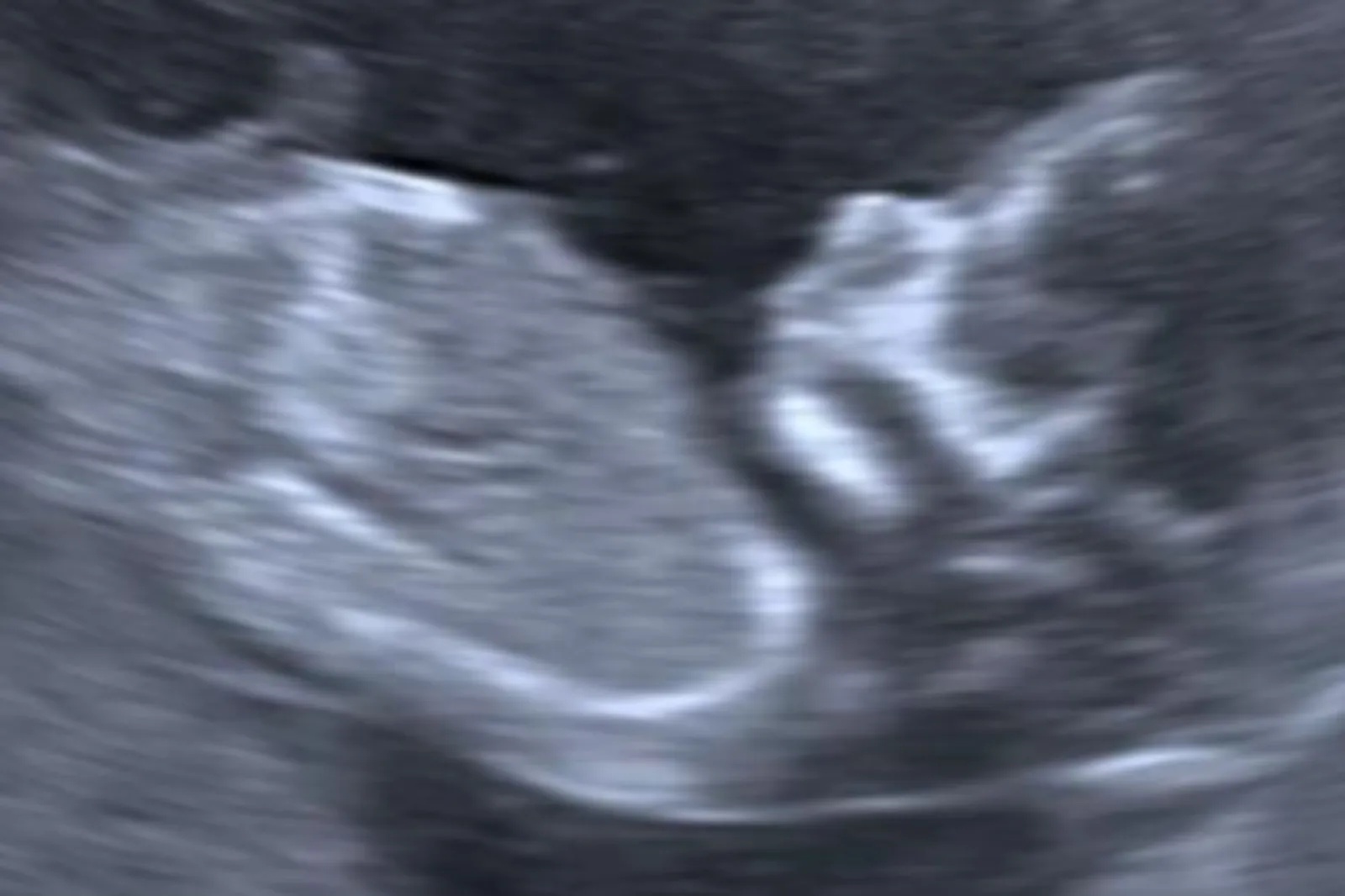 Woman Offered Termination After 20-Week Scan, Stunned by What Happens Next