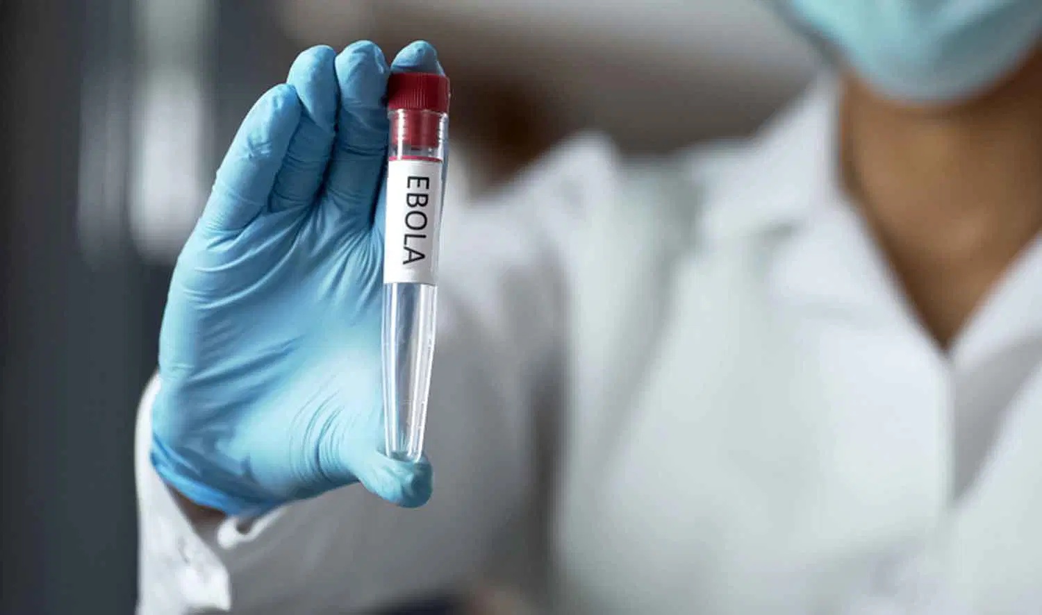 Ebola: FG Finally Breaks Silence, Urges Nigerians To Embrace Self-Care Practices To Contain Outbreak