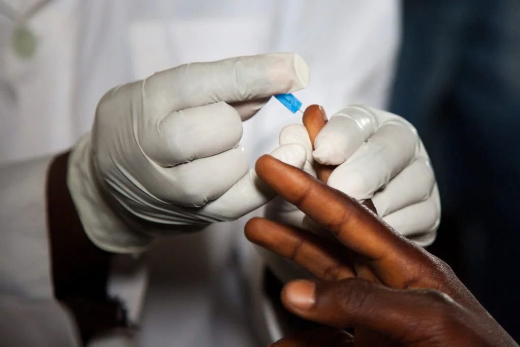 Better data, political will boost Nigeria’s HIV treatment coverage — Expert