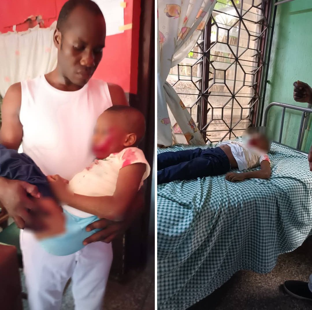 Boy, 4, survives after falling from two-storey building in Aba