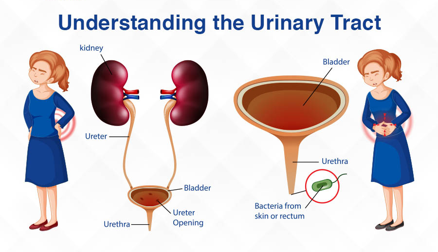 BREAKING: 5 Habits That Can Cause Urine Blockages — Stop Doing These Before It’s Too Late