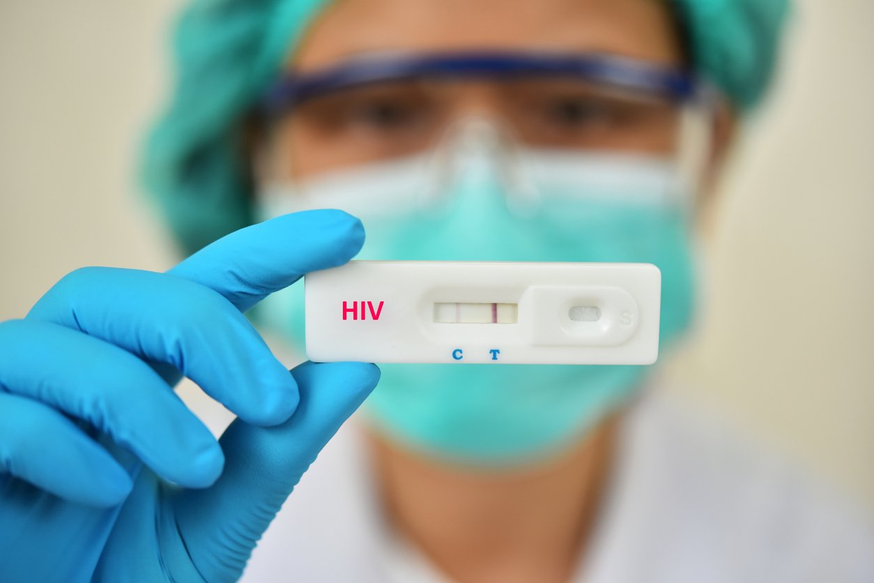 Contracted HIV? Here’s How Many Days Until It Shows on a Test