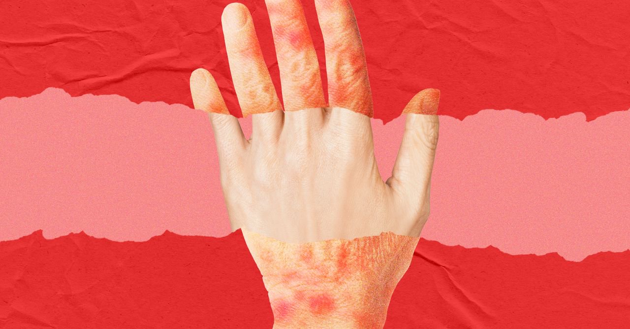A New Anti-Aging Drug Looks to Turn Back the Clock on Skin Age