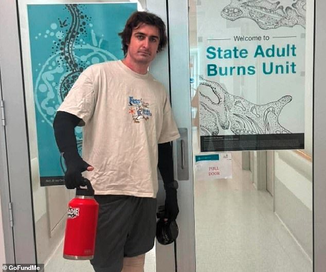 Miracle update for Aussie tradie who nearly died after his robot vacuum exploded inside his home – as he leaves hospital for the first time