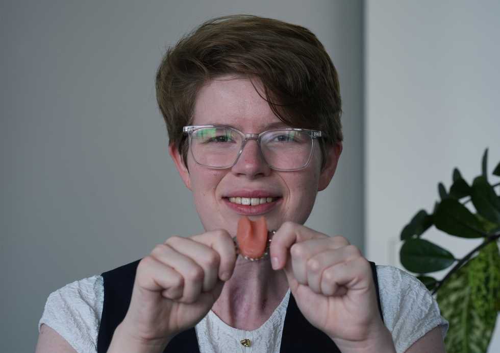Cancer survivor receives artificial tongue in NHS first